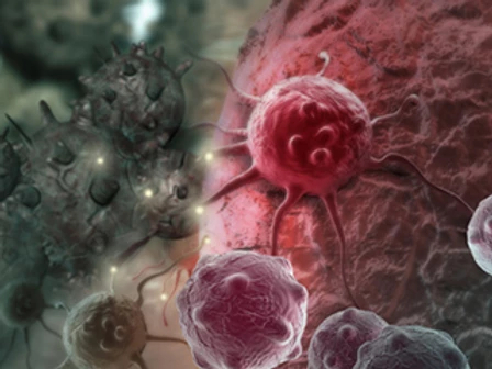 Cancer Cells | Credit: NIH